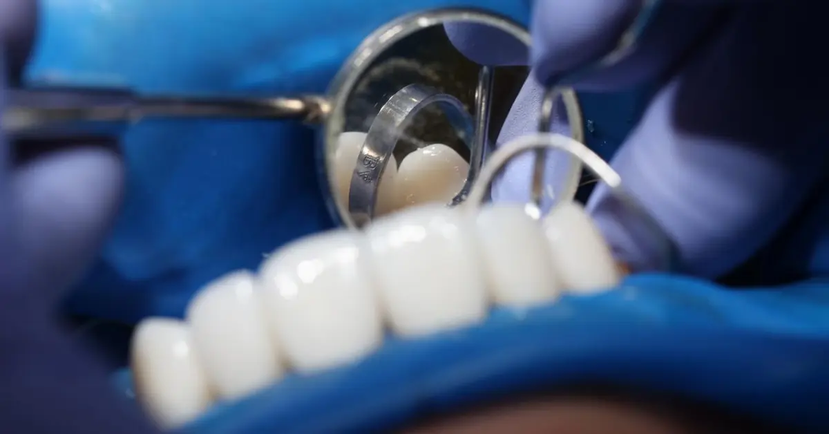 Dental Implants & Pre-Prosthetic Surgery