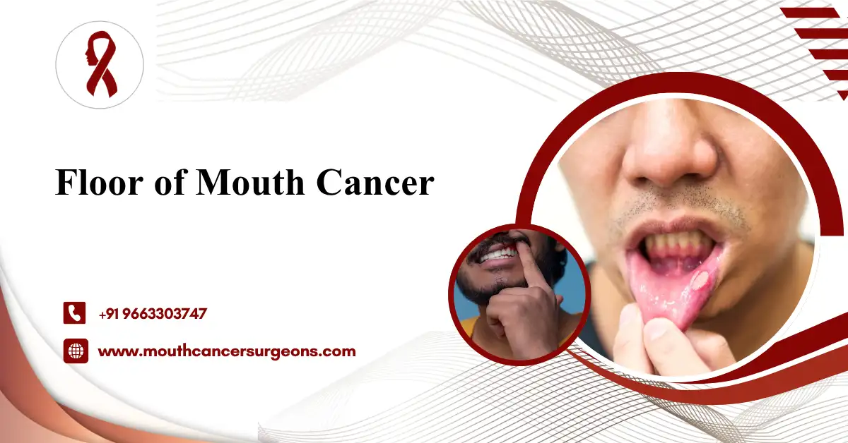 Floor of Mouth Cancer