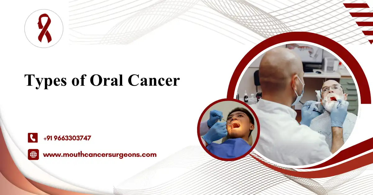Types of Oral Cancer